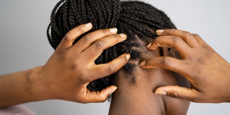 Identifying And Caring For Bumps On The Scalp 4390